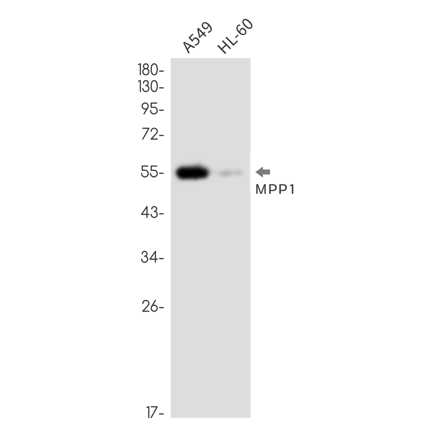 MPP1 Rabbit mAb ABZ3336