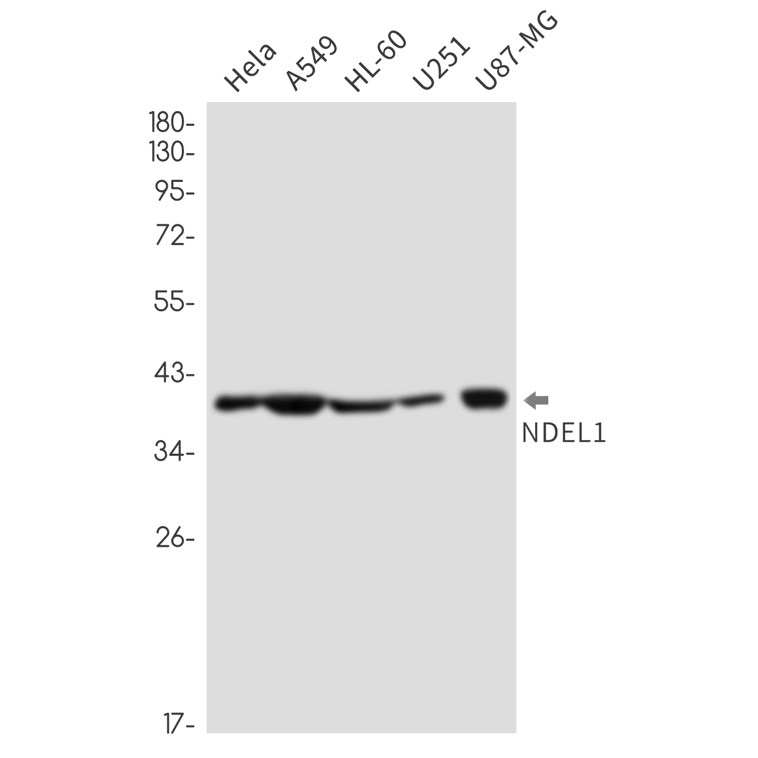NDEL1 Rabbit mAb ABZ3338