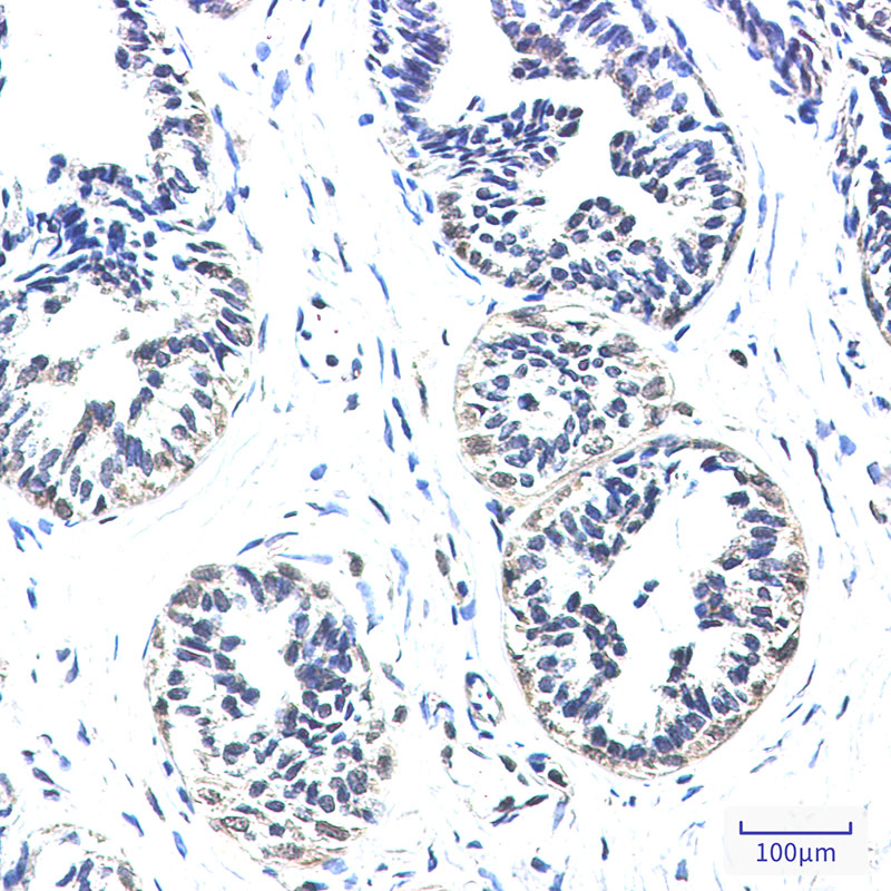 NDUFS2 Rabbit mAb ABZ3339