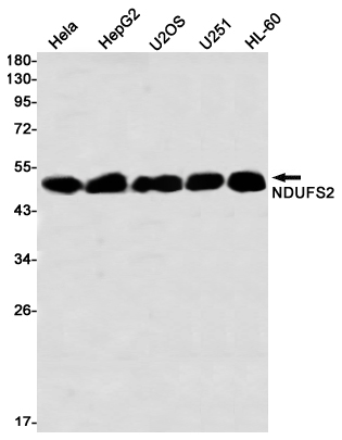 NDUFS2 Rabbit mAb ABZ3339