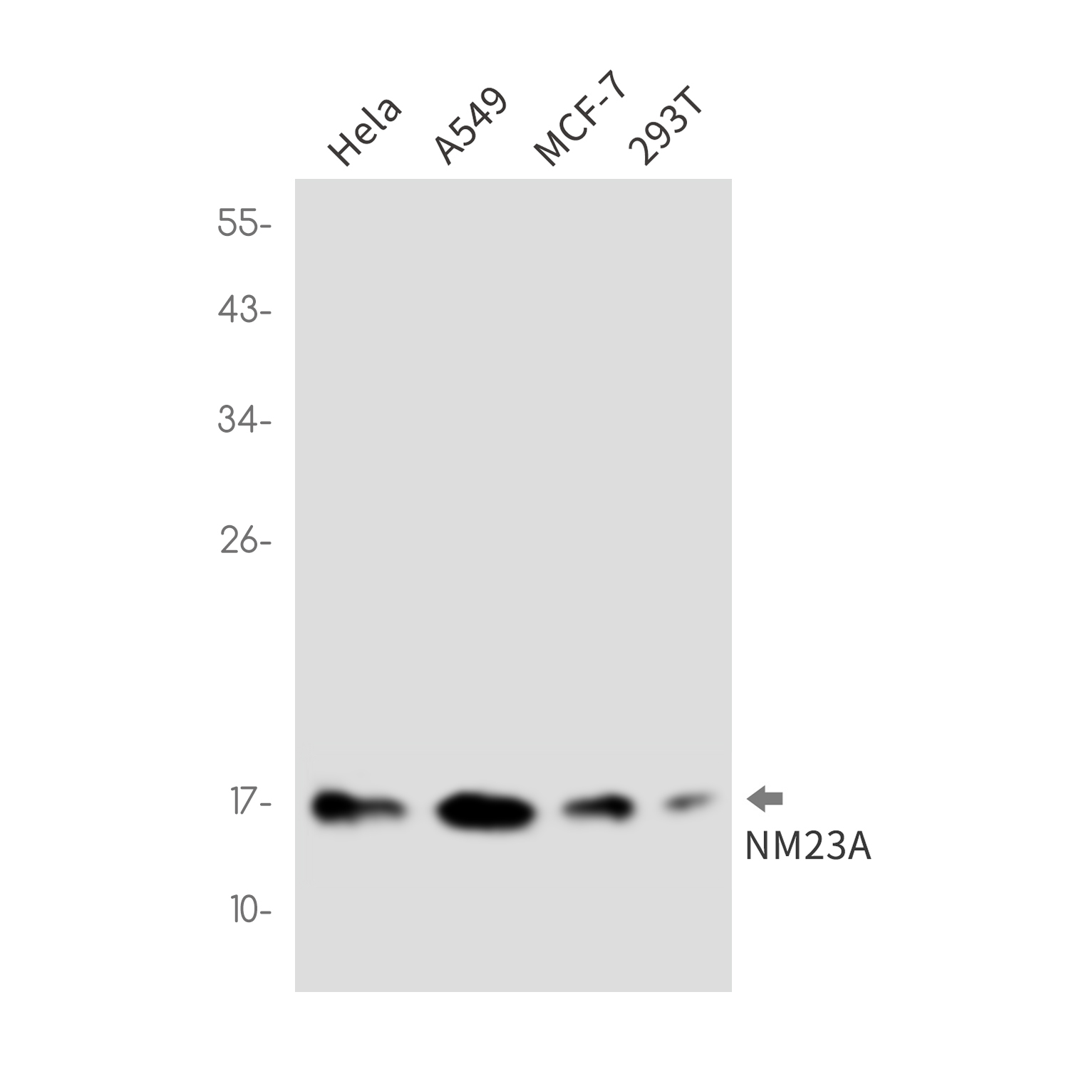 NM23A Rabbit mAb ABZ3340