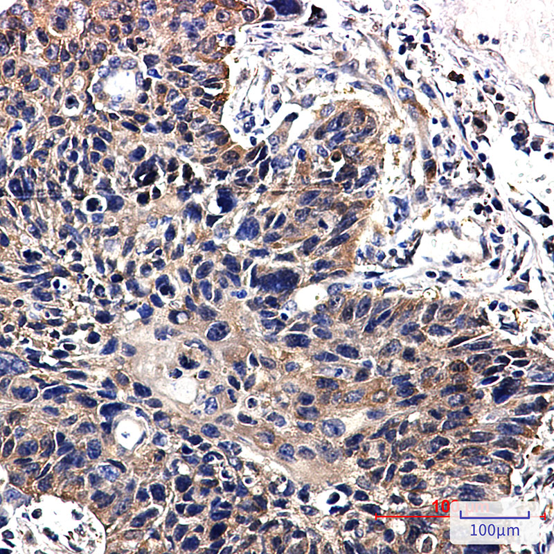 NME2 Rabbit mAb ABZ3341