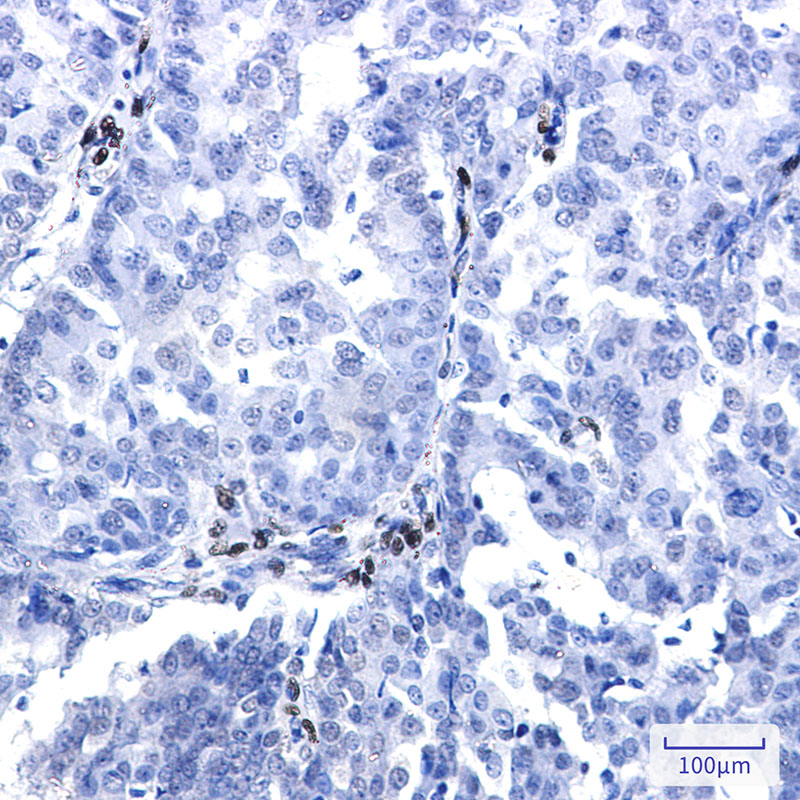 NR2F2 Rabbit mAb ABZ3342