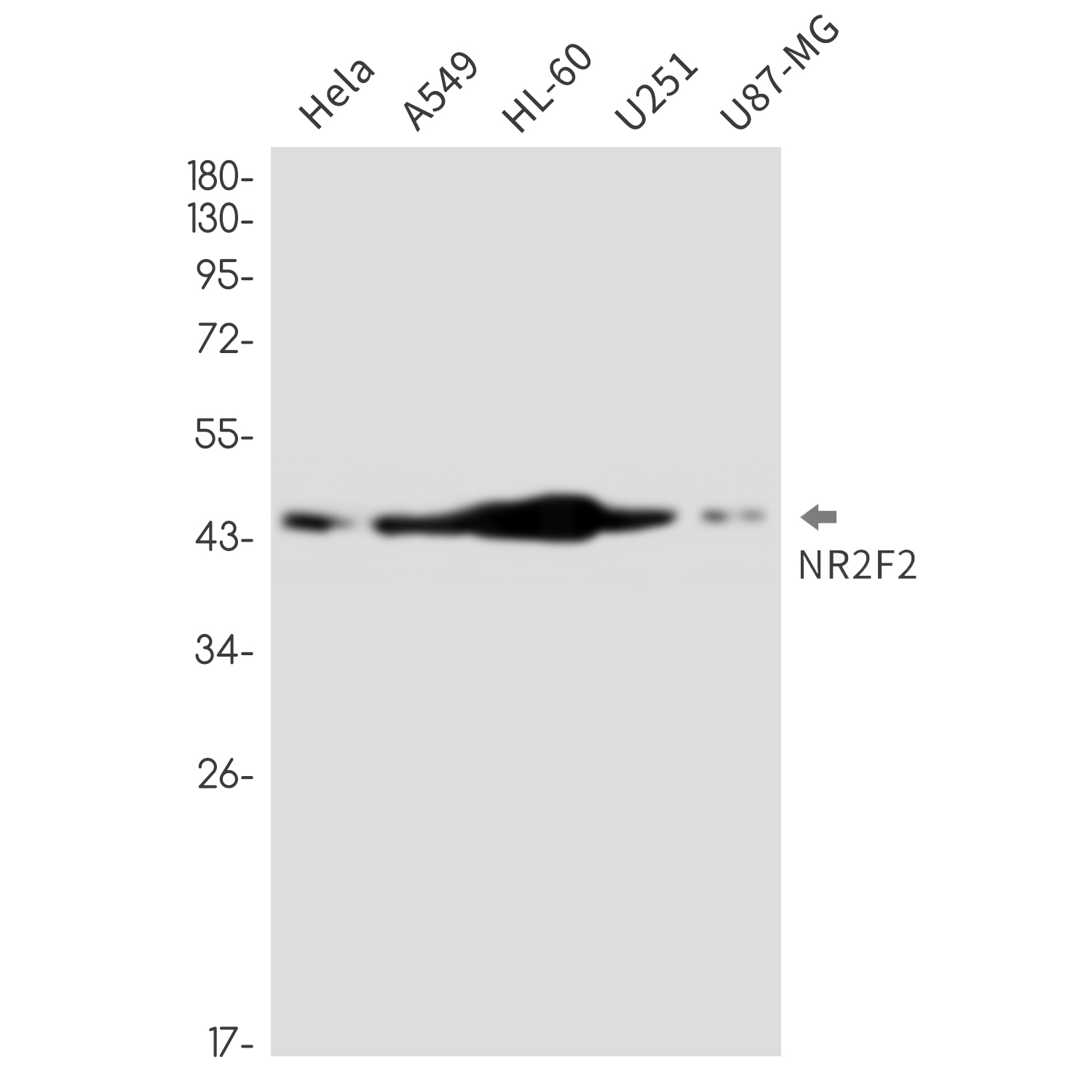NR2F2 Rabbit mAb ABZ3342