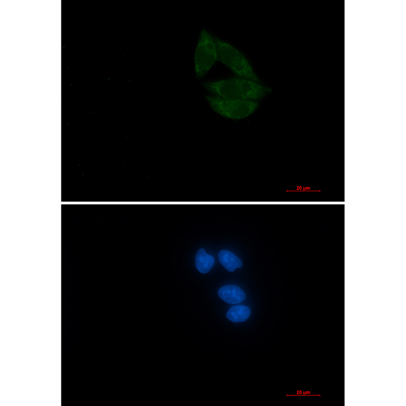 NUP155 Rabbit mAb ABZ3345