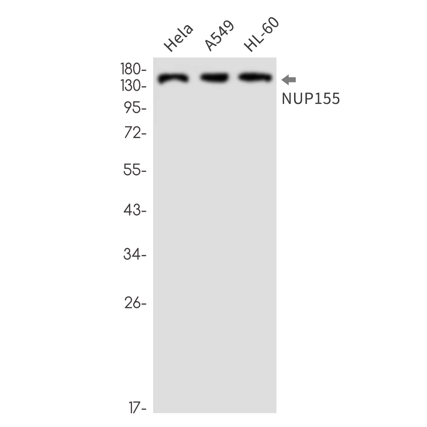 NUP155 Rabbit mAb ABZ3345