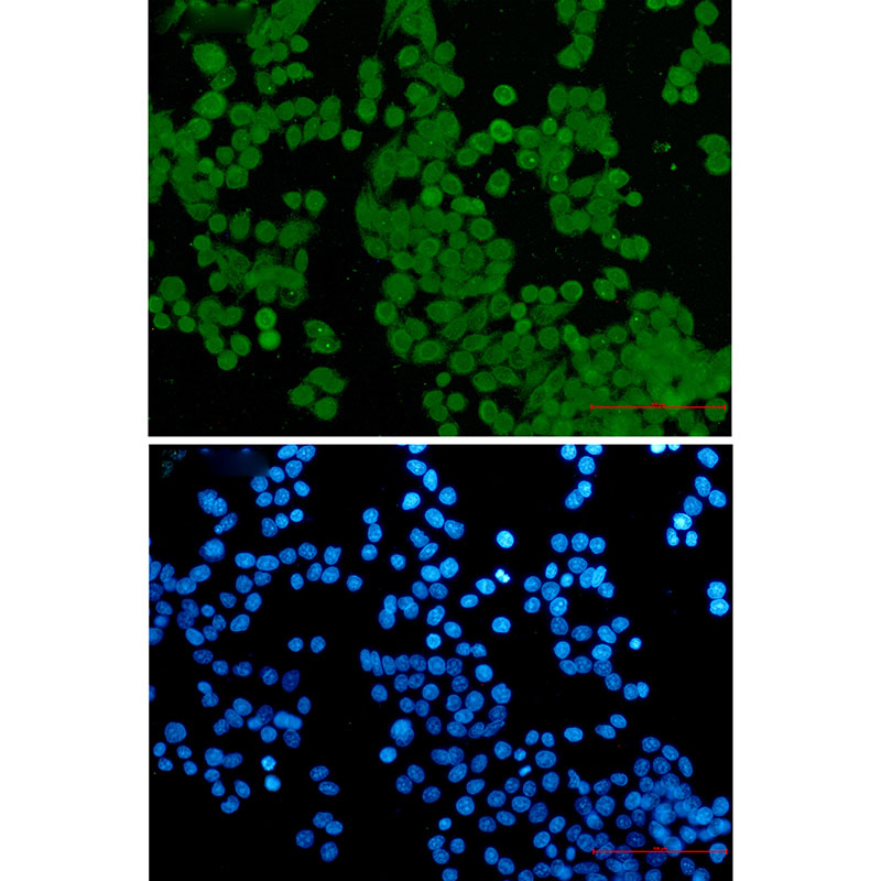 NUP50 Rabbit mAb ABZ3346