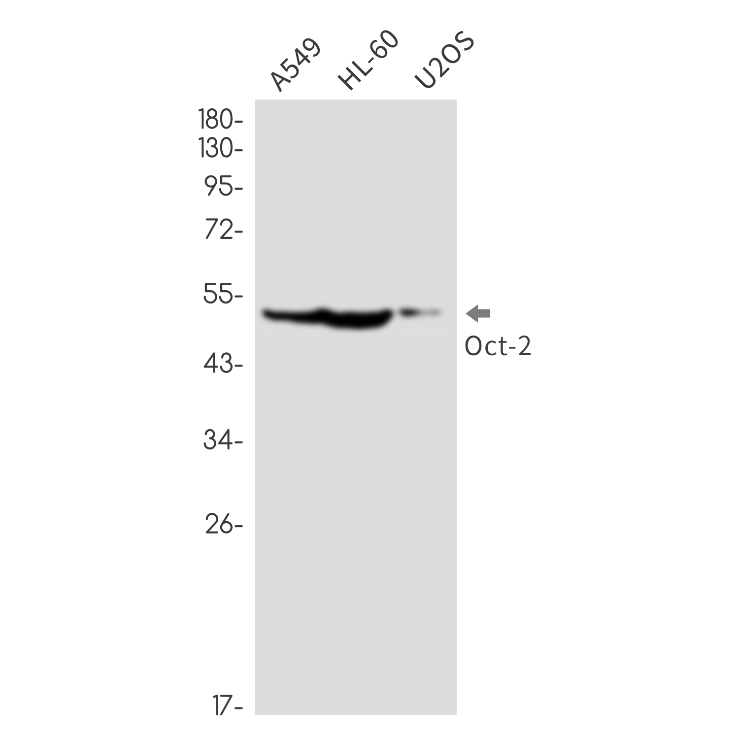 Oct-2 Rabbit mAb ABZ3347
