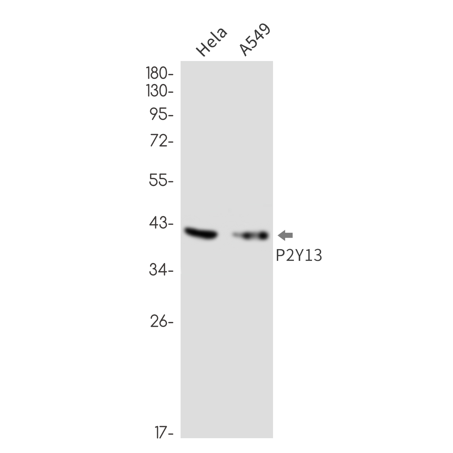 P2Y13 Rabbit mAb ABZ3348