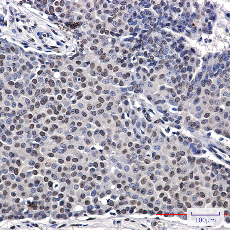 p57 Kip2 Rabbit mAb ABZ3349