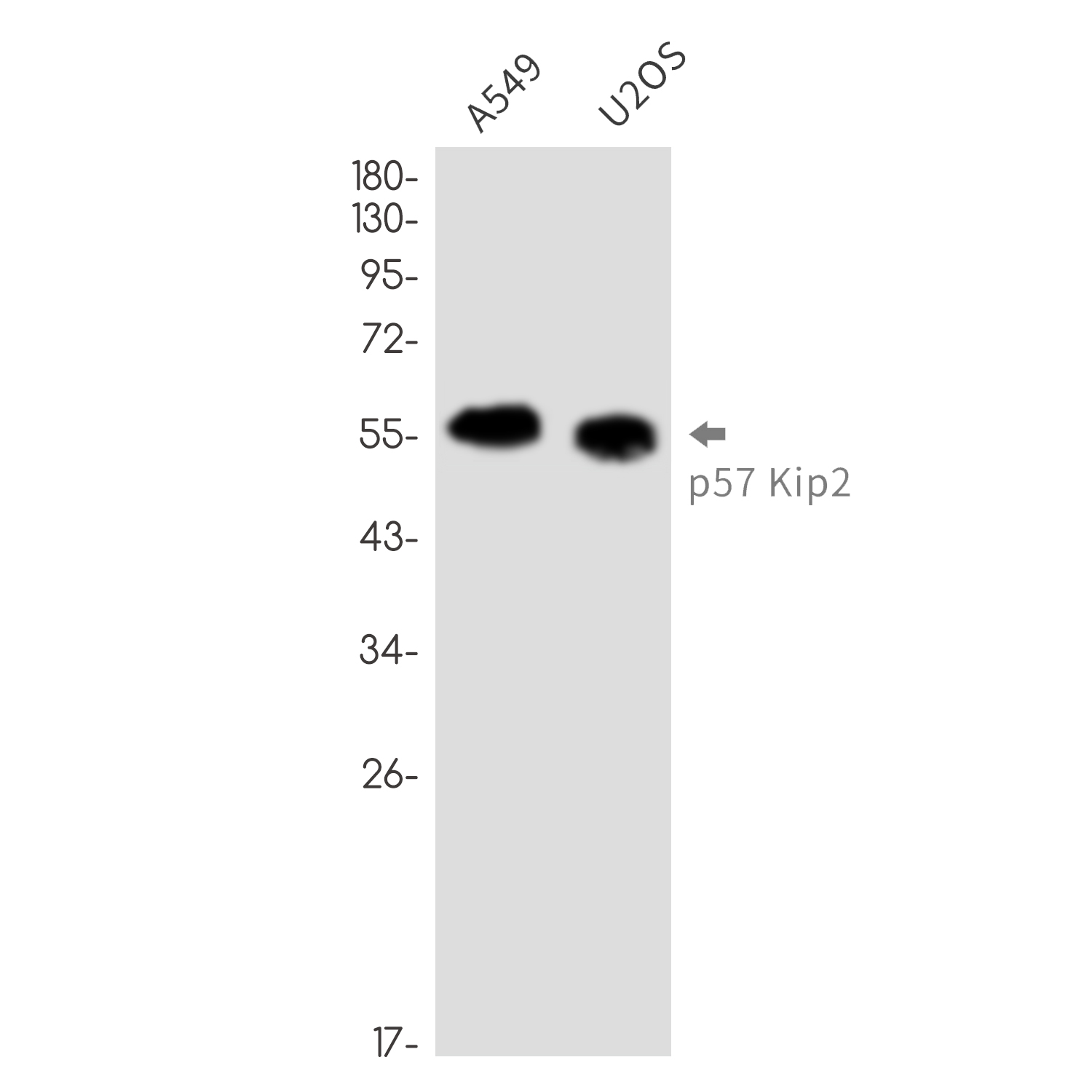 p57 Kip2 Rabbit mAb ABZ3349