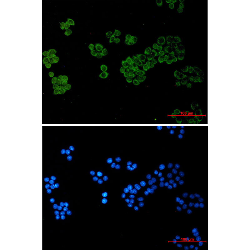 PLC gamma 1 Rabbit mAb ABZ3350