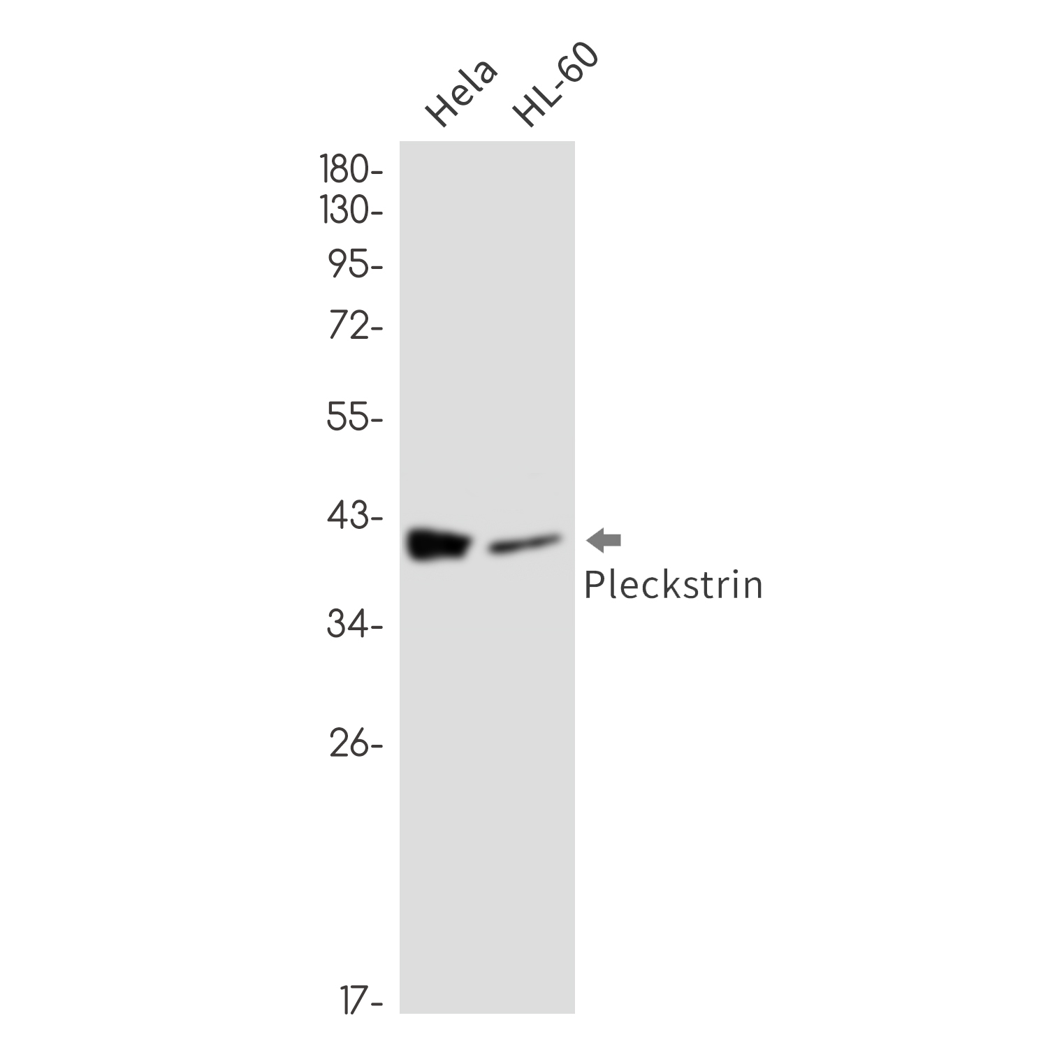 Pleckstrin Rabbit mAb ABZ3351