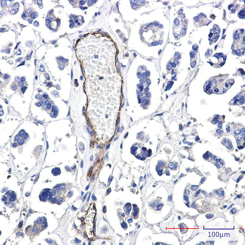 Poliovirus Receptor/PVR Rabbit mAb ABZ3352
