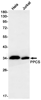 PPCS Rabbit mAb ABZ3354