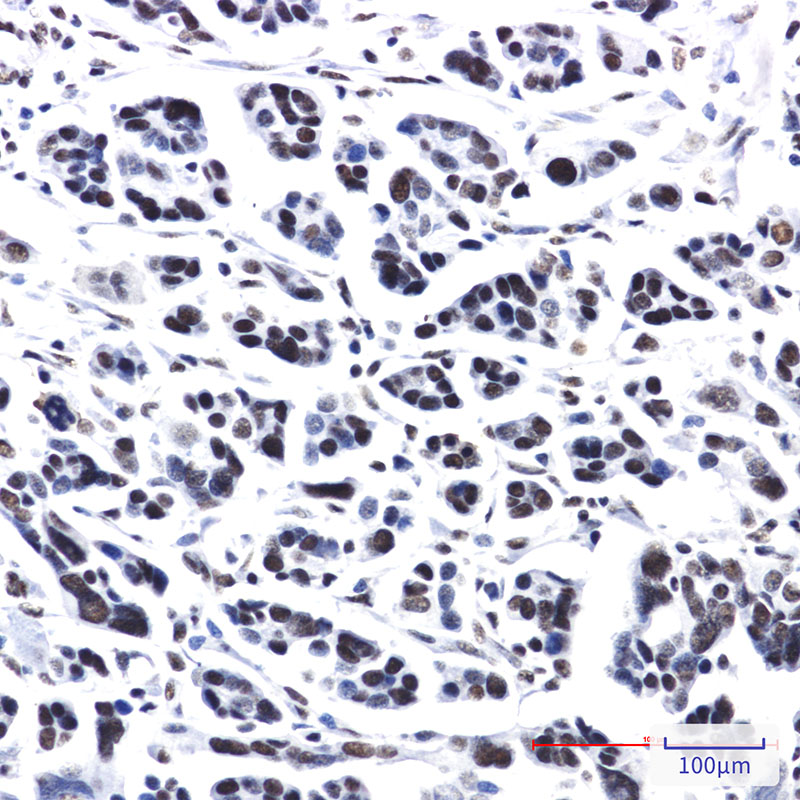 PRPF4 Rabbit mAb ABZ3355