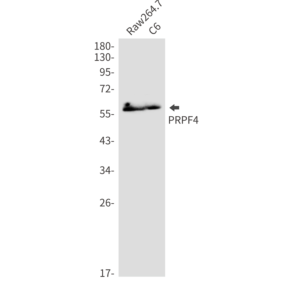 PRPF4 Rabbit mAb ABZ3355