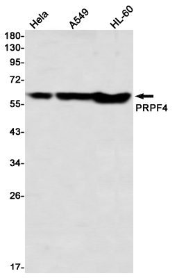 PRPF4 Rabbit mAb ABZ3355