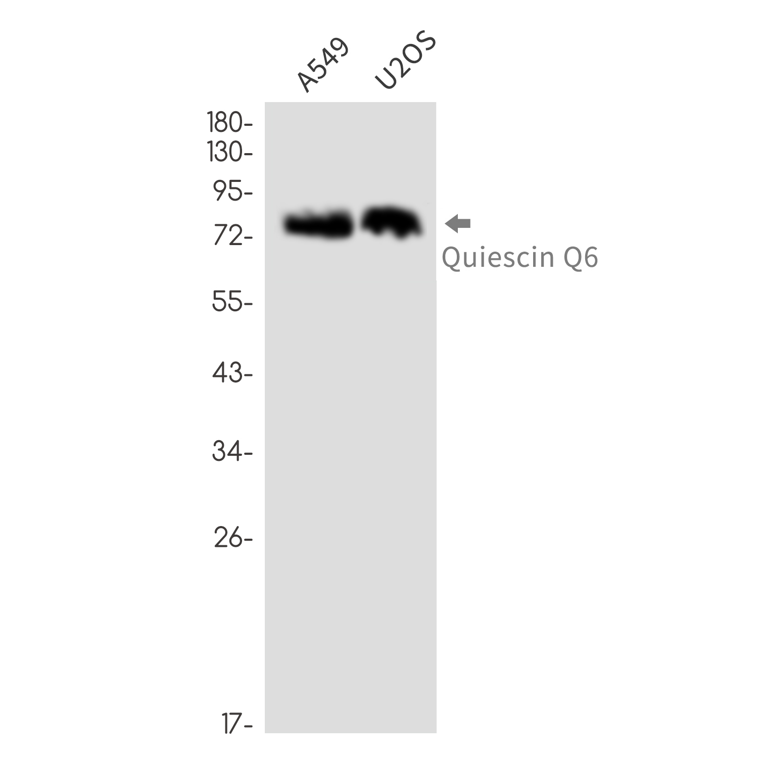 Quiescin Q6 Rabbit mAb ABZ3356