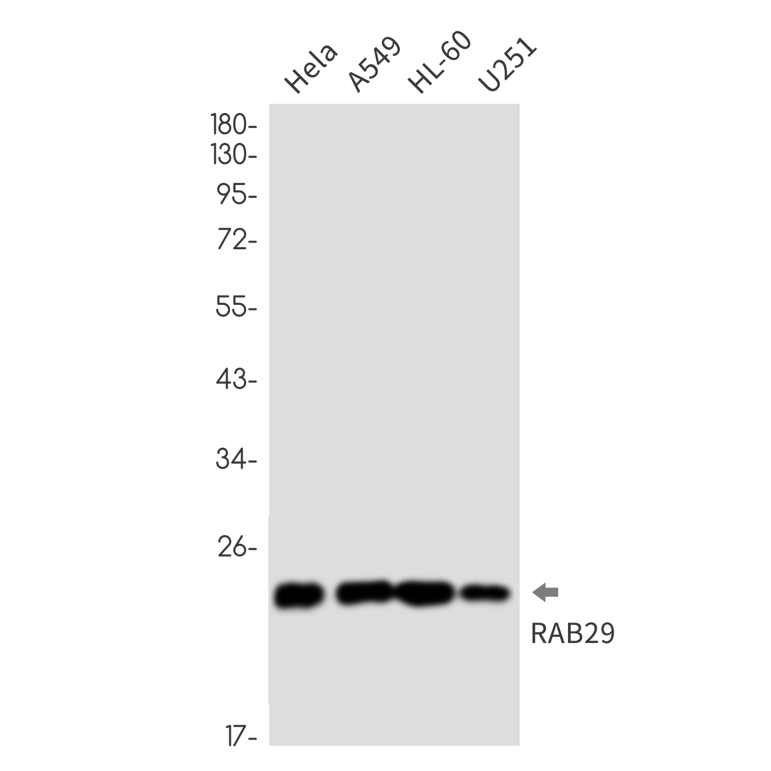 Rab29 Rabbit mAb ABZ3357