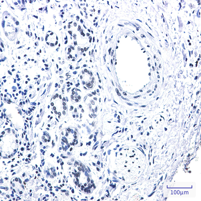 Rad21 Rabbit mAb ABZ3358