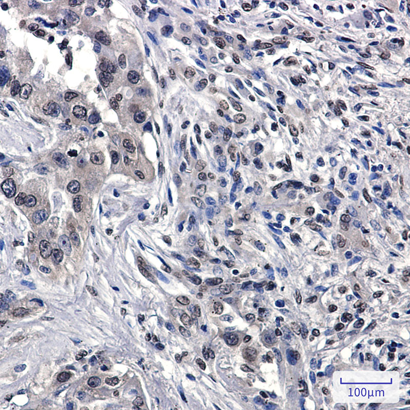 RASA1 Rabbit mAb ABZ3359