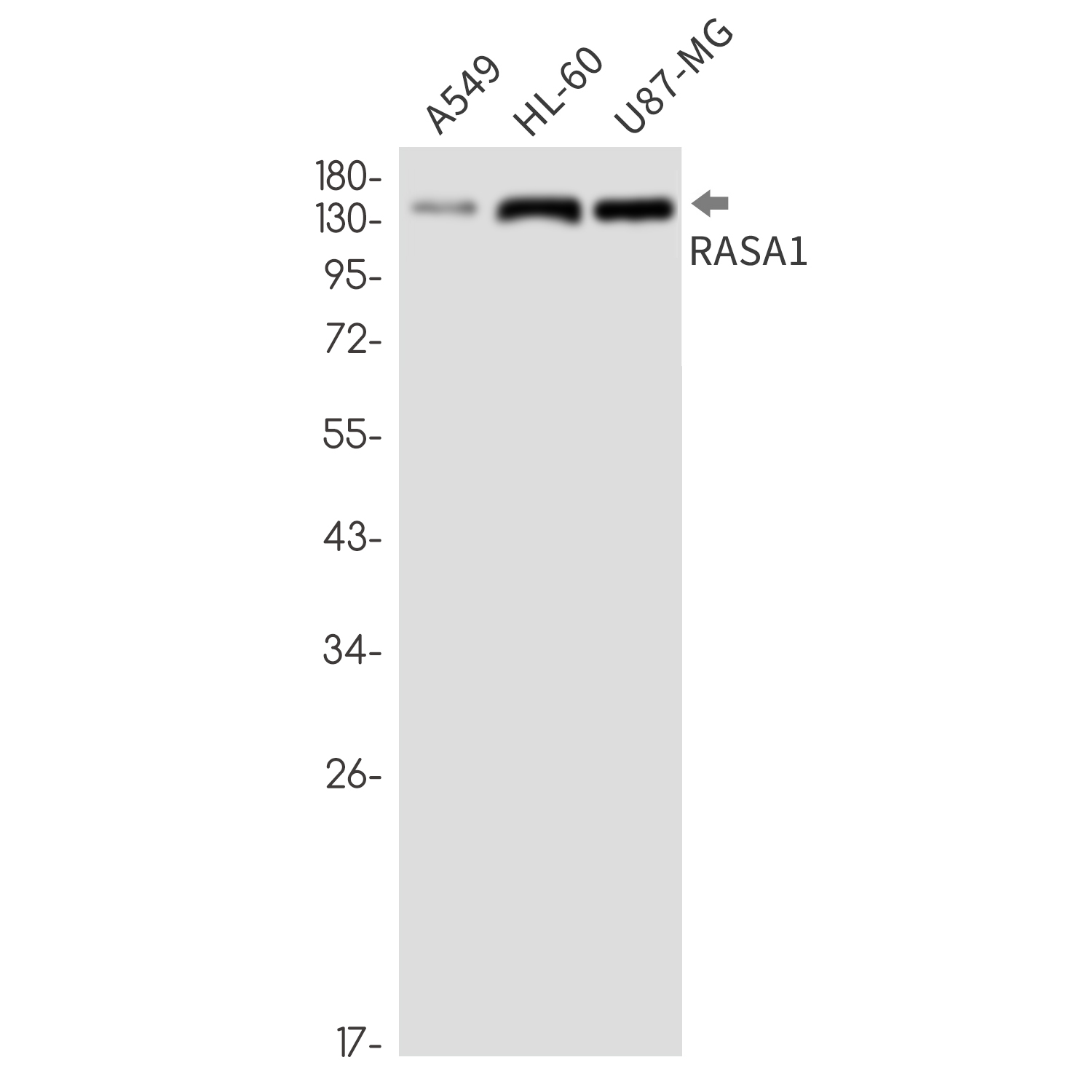 RASA1 Rabbit mAb ABZ3359