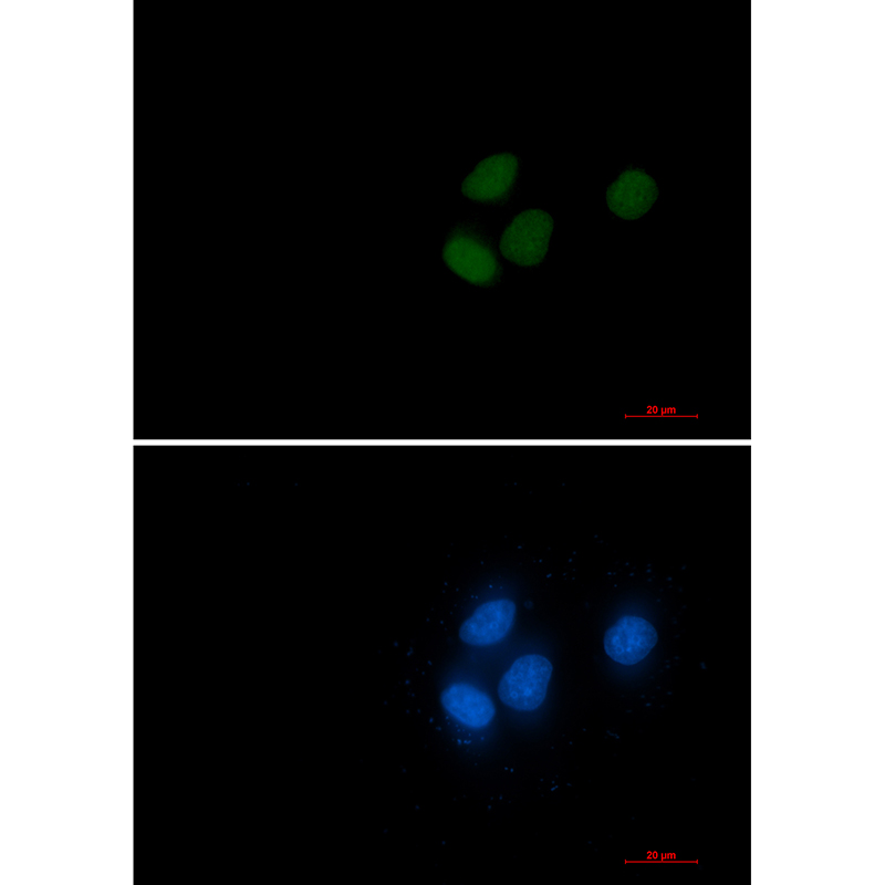 RCC1 Rabbit mAb ABZ3360