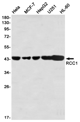 RCC1 Rabbit mAb ABZ3360