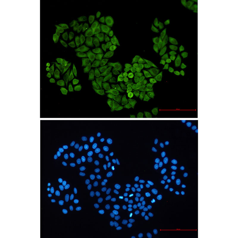 S100 alpha 6 Rabbit mAb ABZ3361