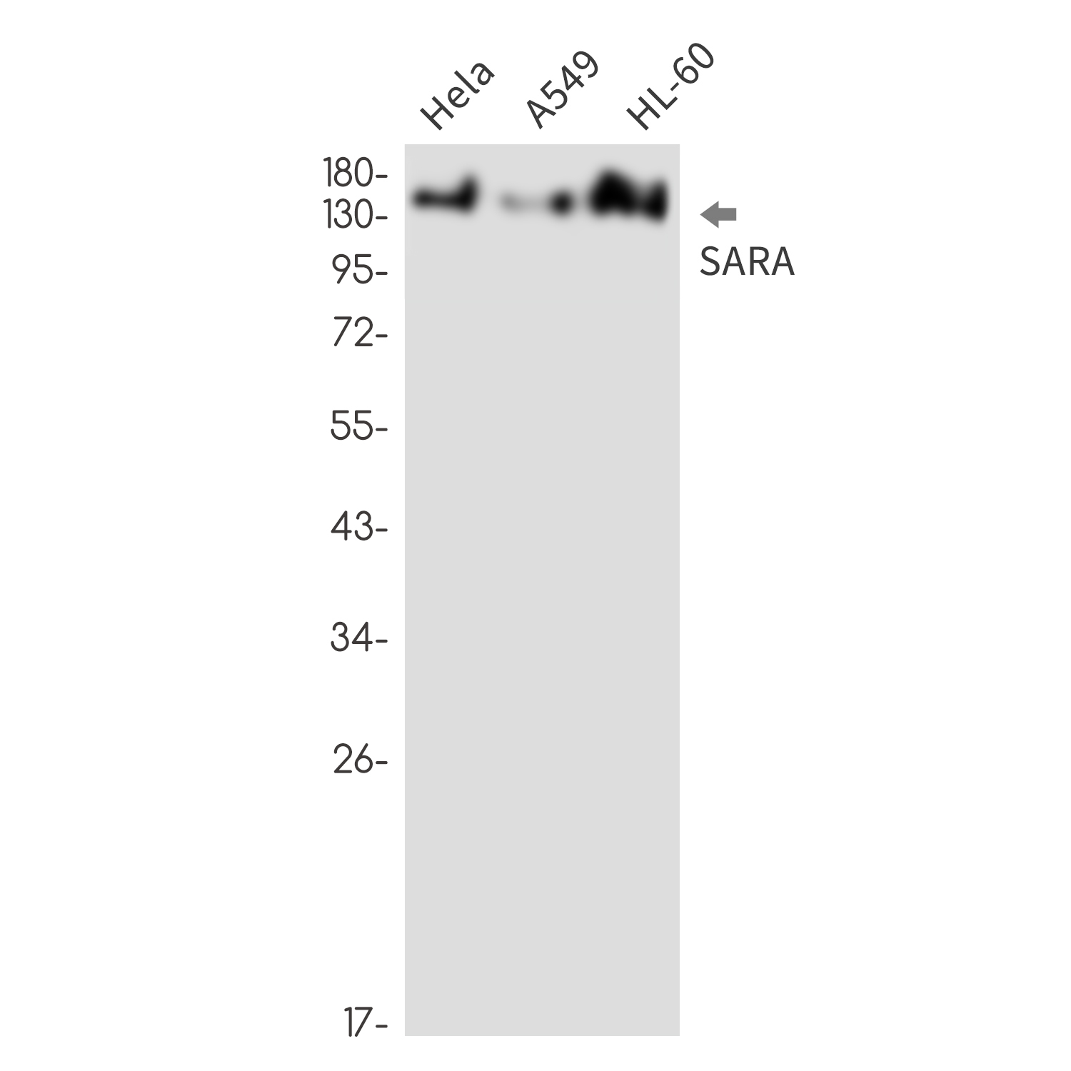 SARA Rabbit mAb ABZ3362