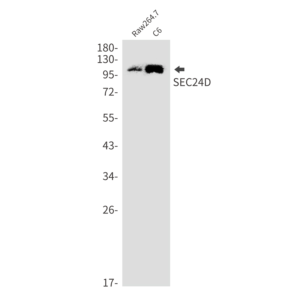 SEC24D Rabbit mAb ABZ3363