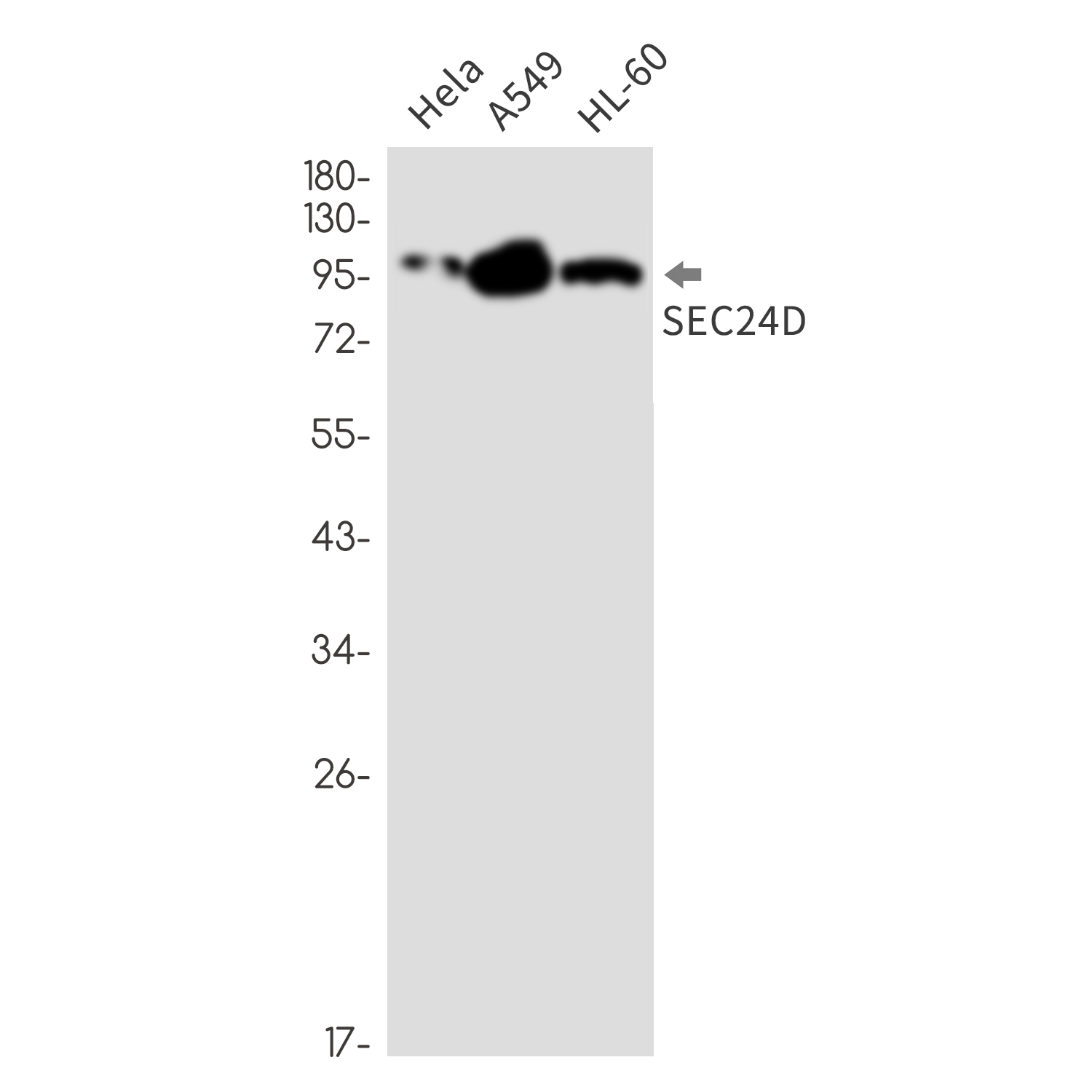 SEC24D Rabbit mAb ABZ3363