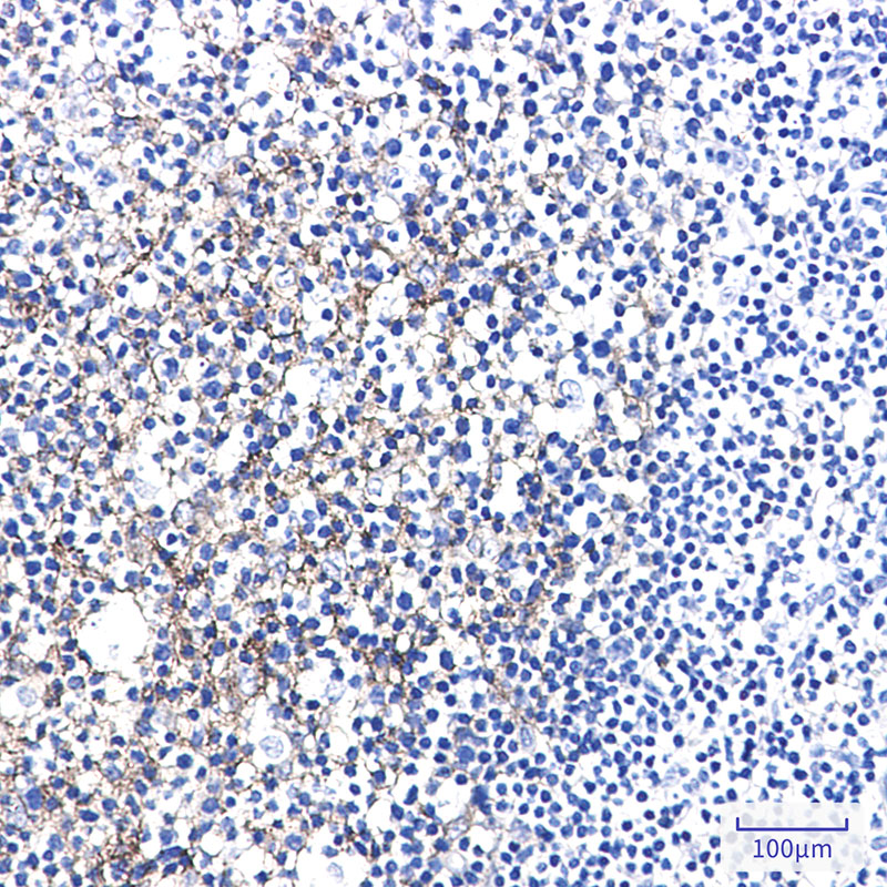 Semaphorin 7A Rabbit mAb ABZ3364