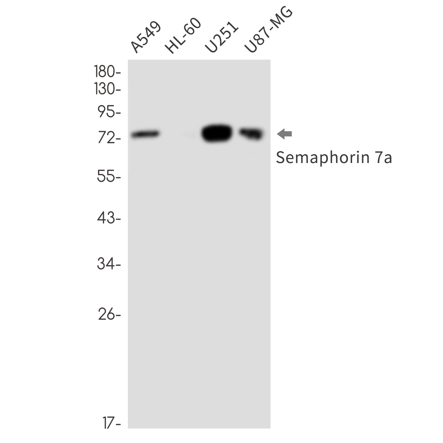 Semaphorin 7A Rabbit mAb ABZ3364