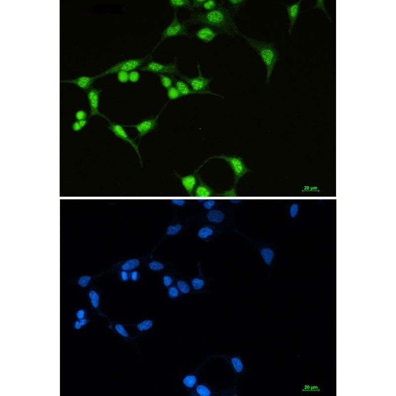 SF3B1 Rabbit mAb ABZ3365