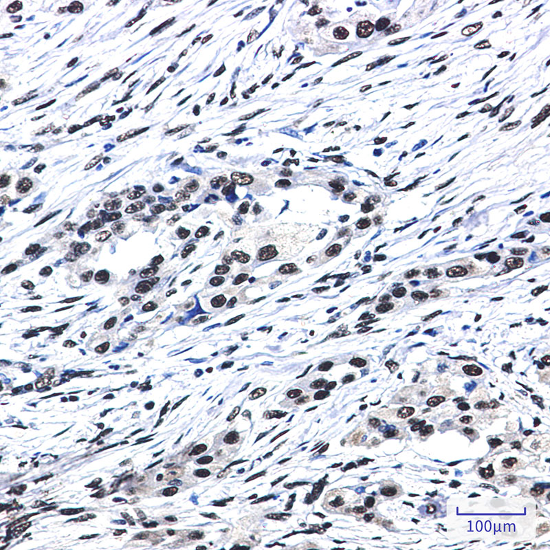 SF3B1 Rabbit mAb ABZ3365