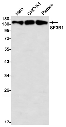 SF3B1 Rabbit mAb ABZ3365