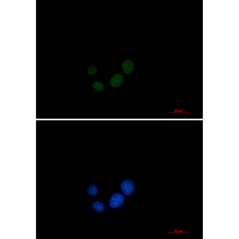 SPT5 Rabbit mAb ABZ3366