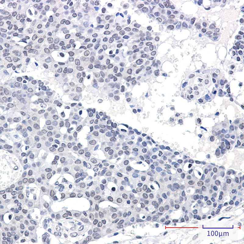 SPT5 Rabbit mAb ABZ3366