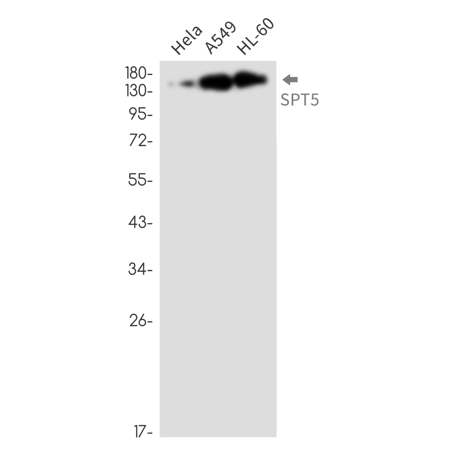 SPT5 Rabbit mAb ABZ3366