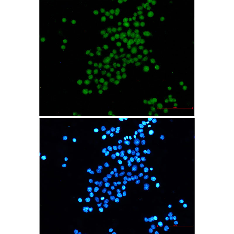 SV40 T Antigen Rabbit mAb ABZ3367