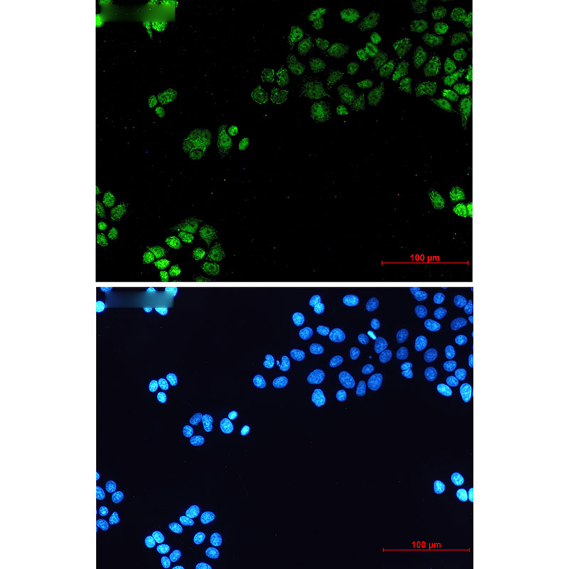 TATA binding protein TBP Rabbit mAb ABZ3368