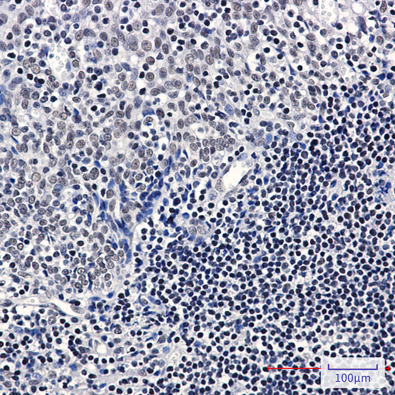 TATA binding protein TBP Rabbit mAb ABZ3368