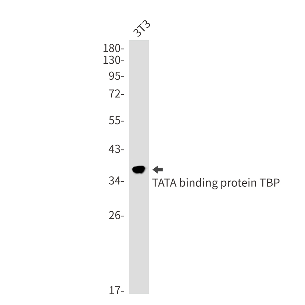 TATA binding protein TBP Rabbit mAb ABZ3368