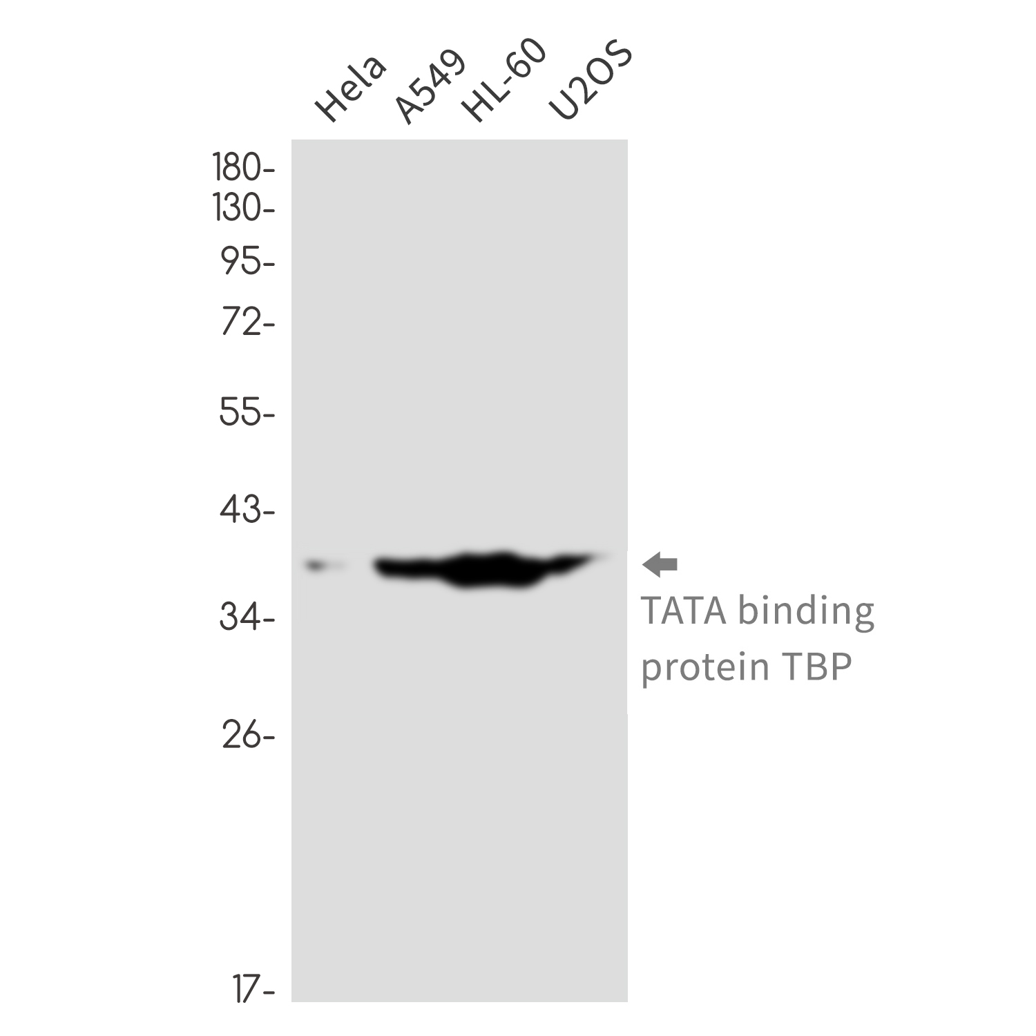 TATA binding protein TBP Rabbit mAb ABZ3368