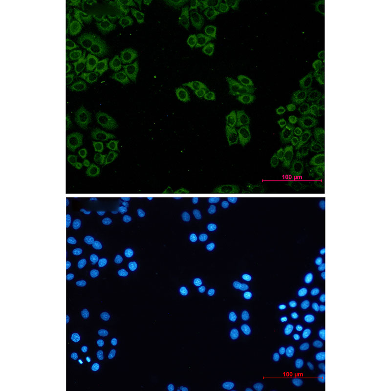 TCP 1 alpha Rabbit mAb ABZ3369