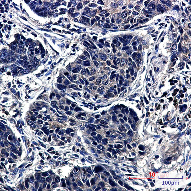 TCP 1 alpha Rabbit mAb ABZ3369