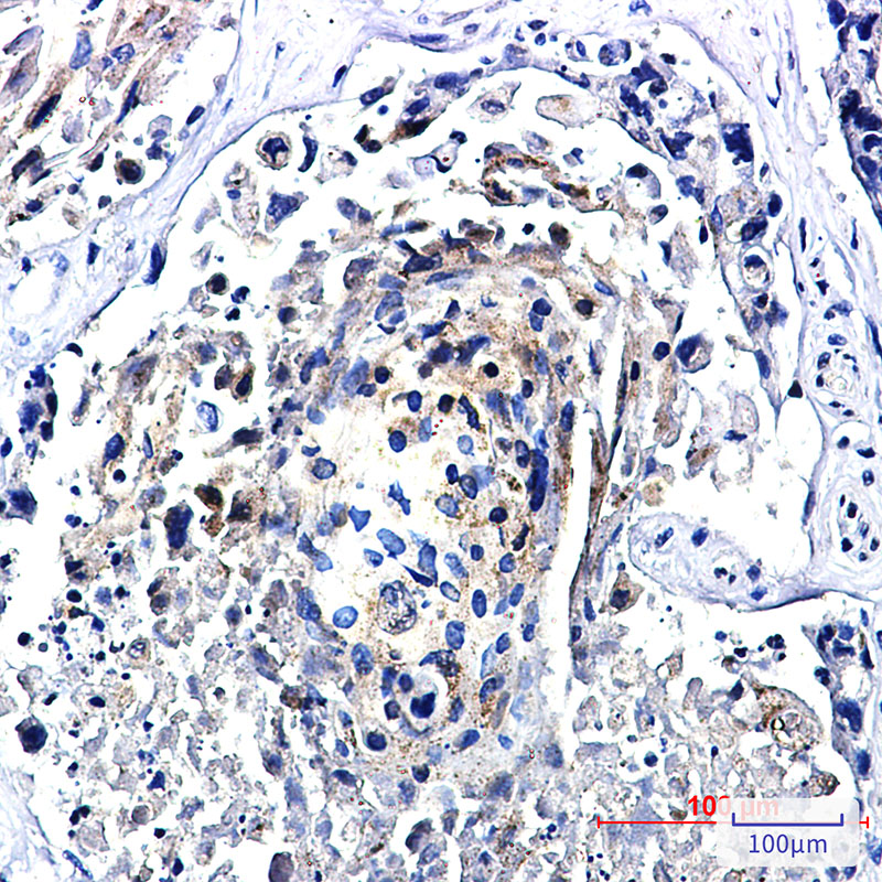 TFEB Rabbit mAb ABZ3370