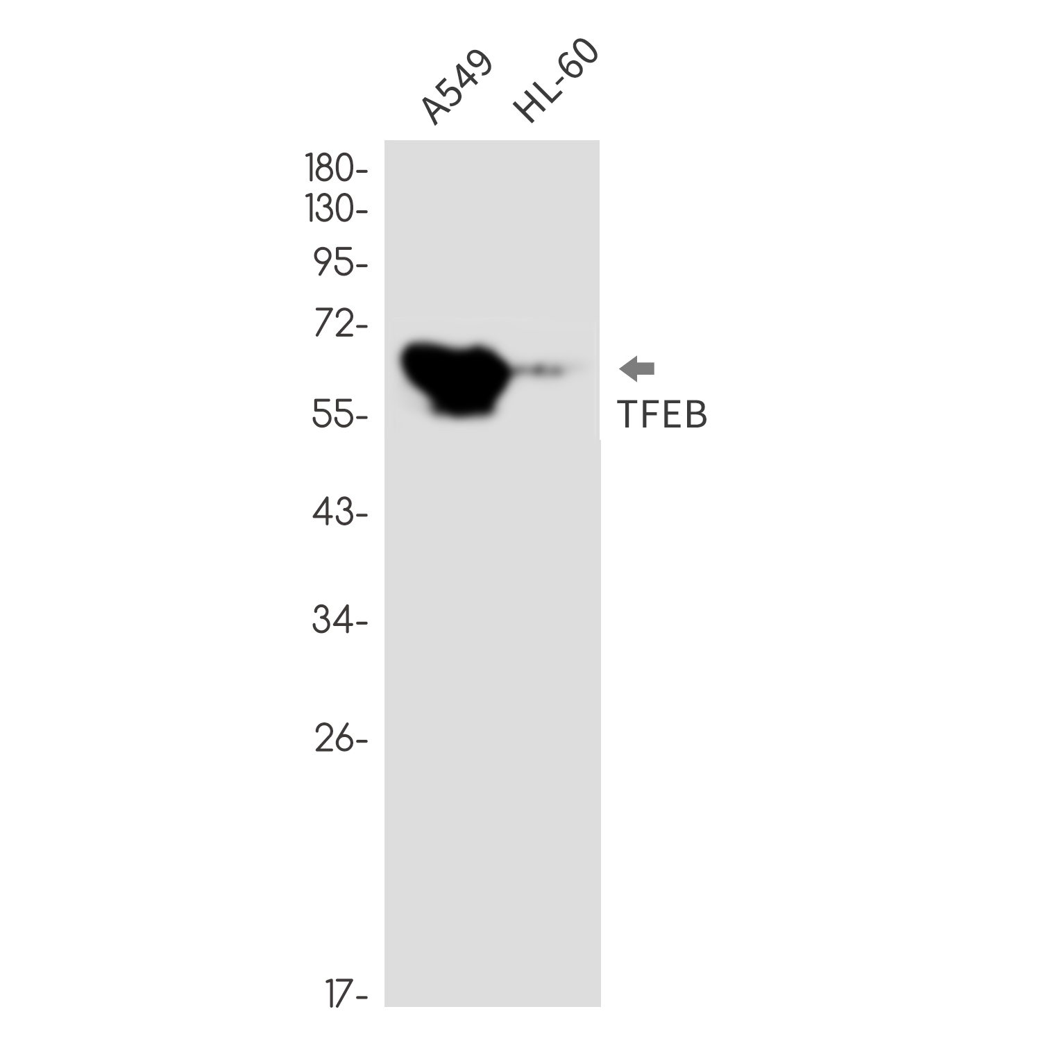 TFEB Rabbit mAb ABZ3370
